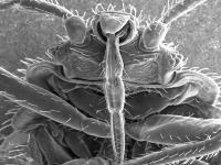全米で猛威を振るう「Bed Bug（南京虫）」の被害に遭ったときの対処法とは？